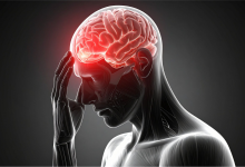 دليل شامل الشقيقة: أعراضها وأنواعها وكيفية تشخيصها